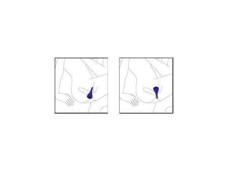 Anillo Vibrador Ping Fuchsia Anillo Vibrador Ping Fuchsia